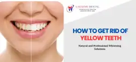 How to Get Rid of Yellow Teeth | Lakshme dental, Tirunelveli