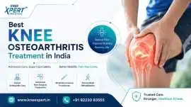 Best Knee Osteoarthritis Treatment in India, Indore