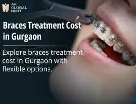 Best Braces Treatment Cost in Gurgaon, Gurgaon