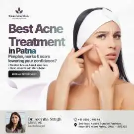 Best Acne Treatment in Patna - Kiran Skin Clinic, Patna