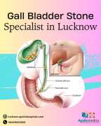 Best Gall Bladder Stone Specialist in Lucknow, Lucknow