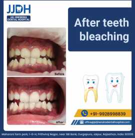 best dental hospital in Jaipur, Jaipur