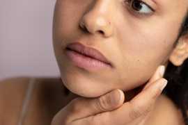Treat Uneven Skin Tone in Jacksonville, Jacksonville