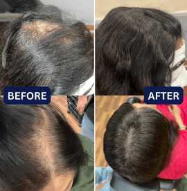 Human Hair Wigs In Bengaluru, Bengaluru