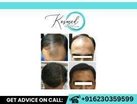 KOSMED- Laser Skin Aesthetics & Hair Transplan, Shimla
