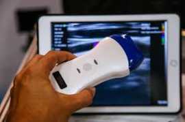 Discover the Future of Medical Imaging with AzmedB, Miami