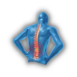 Physical Therapy for Back Pain: Effective Solution, New York
