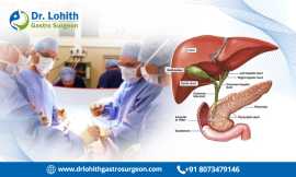 Best Gall Bladder Cancer Surgery in Bangalore, Bengaluru