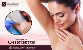 Permanent Laser Hair Removal in Bangalore, Bengaluru