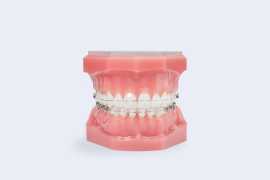 Best Dentist in Noida For Braces, Noida