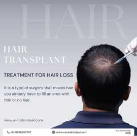 Find Best Hair Transplant In Noida: View Cost , Noida