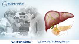 Get the Best Hepatobiliary Care – SumitObesityCare, Bengaluru