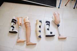 Fast & Reliable Transtibial Prosthesis Repair, Woodlands New Town