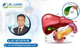 Best Gall Bladder Surgeon in Sarjapur Road, Bengaluru