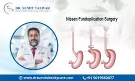 Best Fundoplication Doctors in Bangalore, Bengaluru