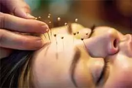 Acupuncture Clinic in Chicago, Chicago