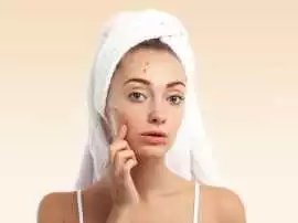 Call us +34-676 60 88 60 Professional Face Spots, Alicante