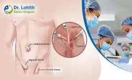 Best Doctor for Hernia Surgery in Sarjapur Road, Bengaluru