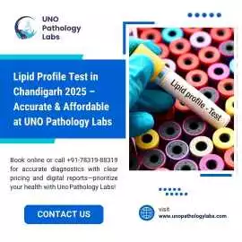 Lipid Profile Test in Chandigarh 2025 – Accurate &, Mohali