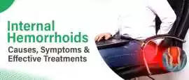 Minimally Invasive Treatments for Internal Hemorrh, Noida