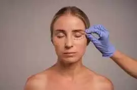 Choose the Blepharoplasty – Refresh Your Look Safe, Adelaide
