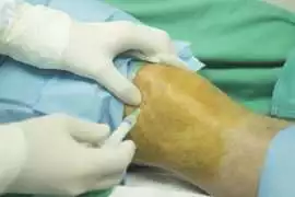 Expert Knee Surgeon in Warrington, Manchester