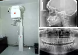 X-Ray & OPG X-Ray in South Delhi , New Delhi