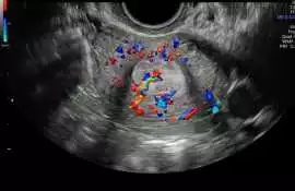 Color Doppler in South Delhi, New Delhi