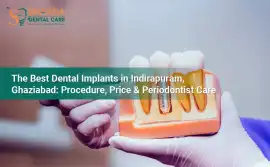 Dental Implants Indirapuram for a Perfect Smile, Ghaziabad