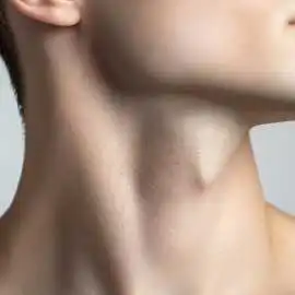 Neck Lift Surgery in Los Angeles, Los Angeles