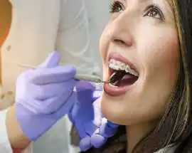 Dental Cleaning Fort Worth | Professional Teeth , Fort Worth