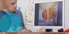 Private Consultation with Urologist Cape Town, Cape Town