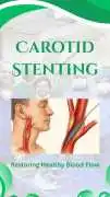 Carotid Stent: Minimally Invasive Protection Again, Chandigarh
