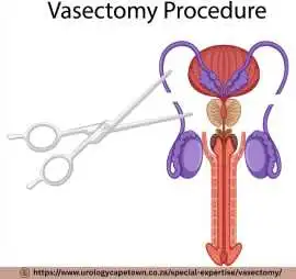 Reliable Male Contraception Services in Cape Town, Cape Town