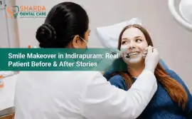 Best smile makeover dentist in Indirapuram, Ghaziabad