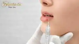 Premium Lip Fillers Riverside for Plump Lips, Riverside