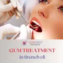 Gum Treatment in Tirunelveli, Tirunelveli