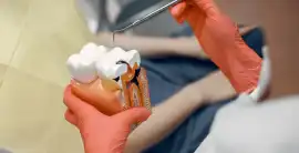 Best Dentist in Madurai, Madurai