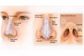 Looking for Nose Plastic Surgery in Singapore? Boo, Bukit Timah