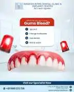 Bleeding Gums? Get Expert Gum Treatment Before It , New Delhi