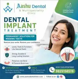 Dental Implants Treatment Ahmedabad | DR. Manish, Ahmedabad