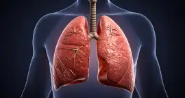 Expert Lungs Doctor in Siliguri For Allergy Manage, Siliguri