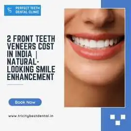 2 Front Teeth Veneers Cost in India |Natural Smile, Chandigarh