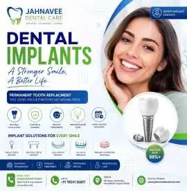 Dental Implants in Ahmedabad - Jahnavee Dental, Ahmedabad