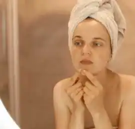 Say Goodbye to Acne with Expert Treatment in Delhi, Gurgaon