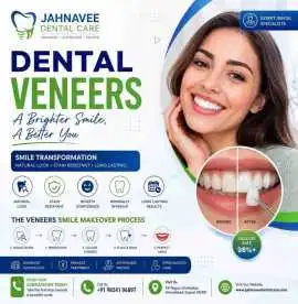 Cosmetic Dental Veneers Treatment - Dental care, Ahmedabad