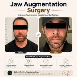 Jaw Augmentation Near Me | Jaw Augmentation Surger, San Francisco