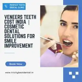 Veneers Teeth Cost India | Cosmetic Solutions, Mohali