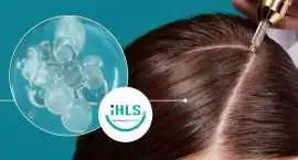 Discover Benefits of Peptides for Hair Restoration, Subiaco