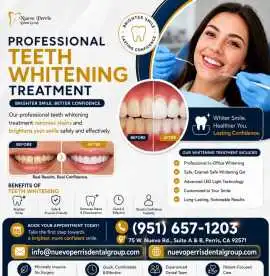 Teeth Whitening Treatment in Perris | Dr. Tejas, Perris